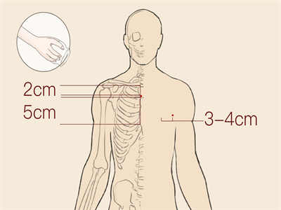 擴(kuò)心病的最新治療